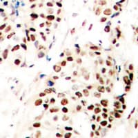 Polyclonal Rabbit anti-Human SNAI1 + SNAI2 Antibody (C-Terminus, IHC, IF, WB)