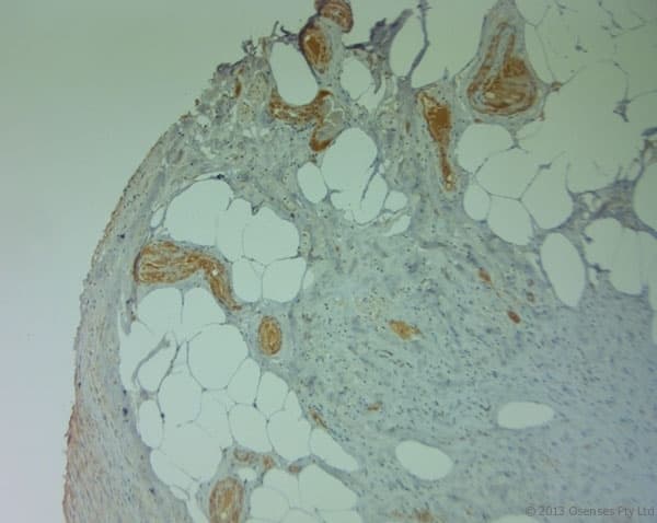 PLIN4 / S3-12 Antibody (aa1050-1100)