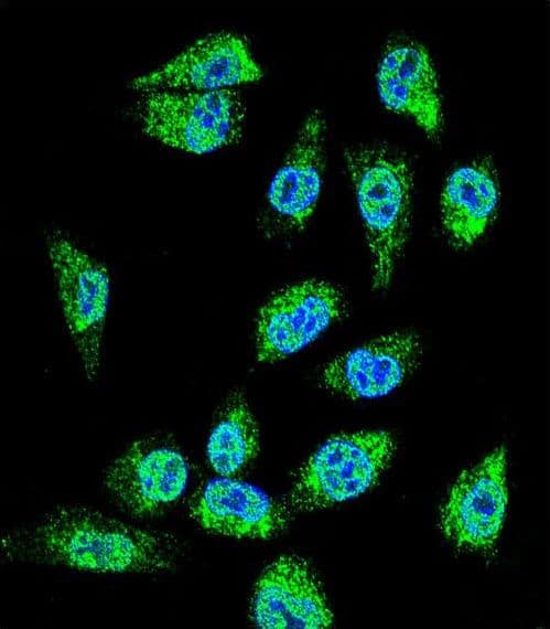 C18orf8 / MIC1; Antibody (aa34-66)