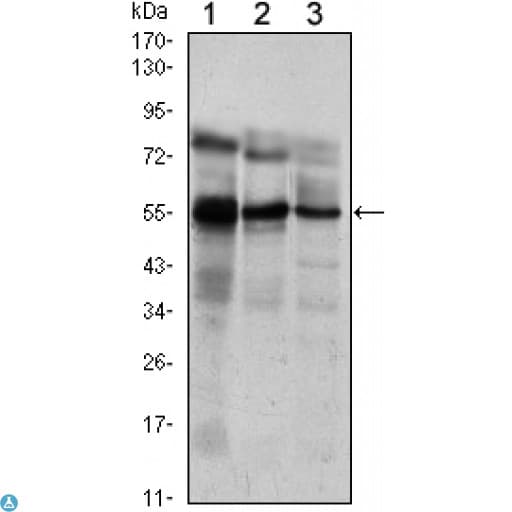 Monoclonal Mouse anti-Human ETV5 / ERM Antibody (WB)