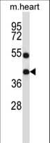 DTX3 Antibody (aa20-48)
