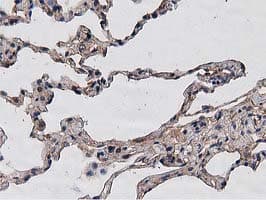 HDAC6 Antibody (clone OTI3E7)