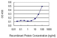 SNRPB / COD Antibody (clone 1B4)