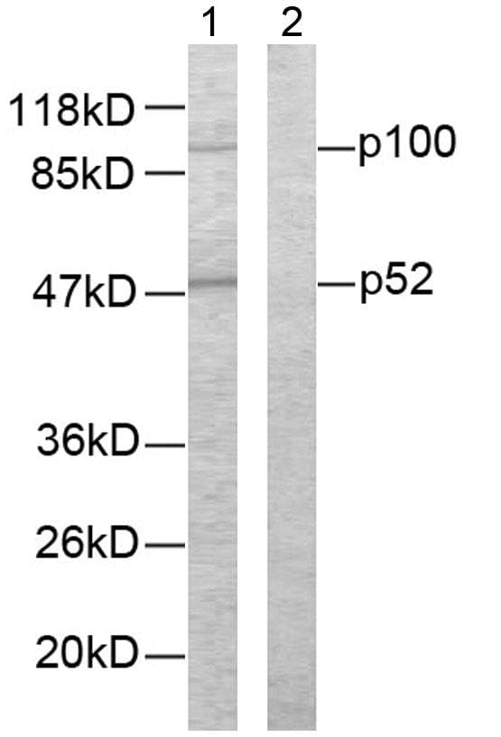 Polyclonal Rabbit anti-Human NFKB2 Antibody (aa833-882, IHC, WB)