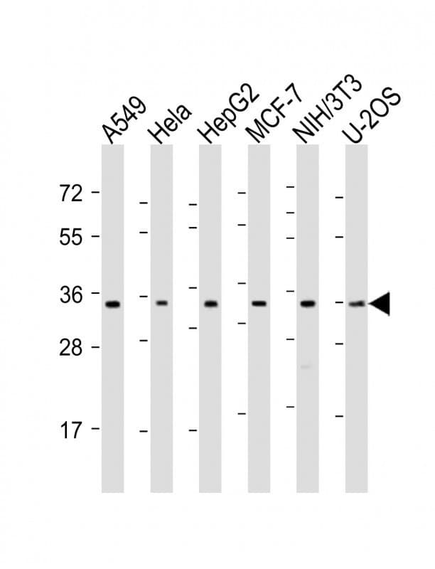 OTUB1 / OTU1 Antibody (aa185-219)