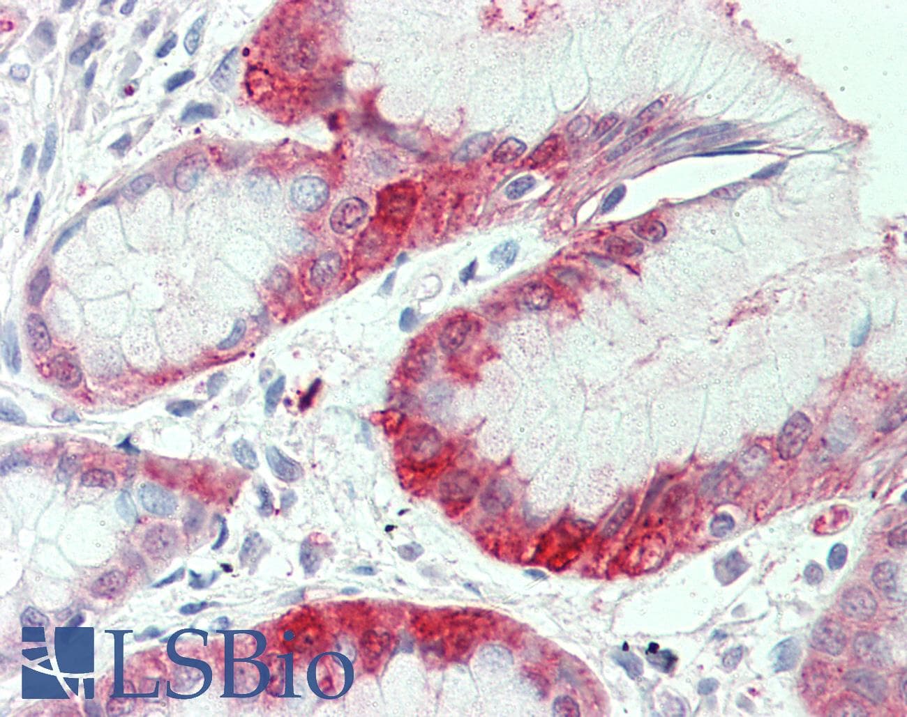 IHC-plus™ SLC7A2 Antibody (C-Terminus)