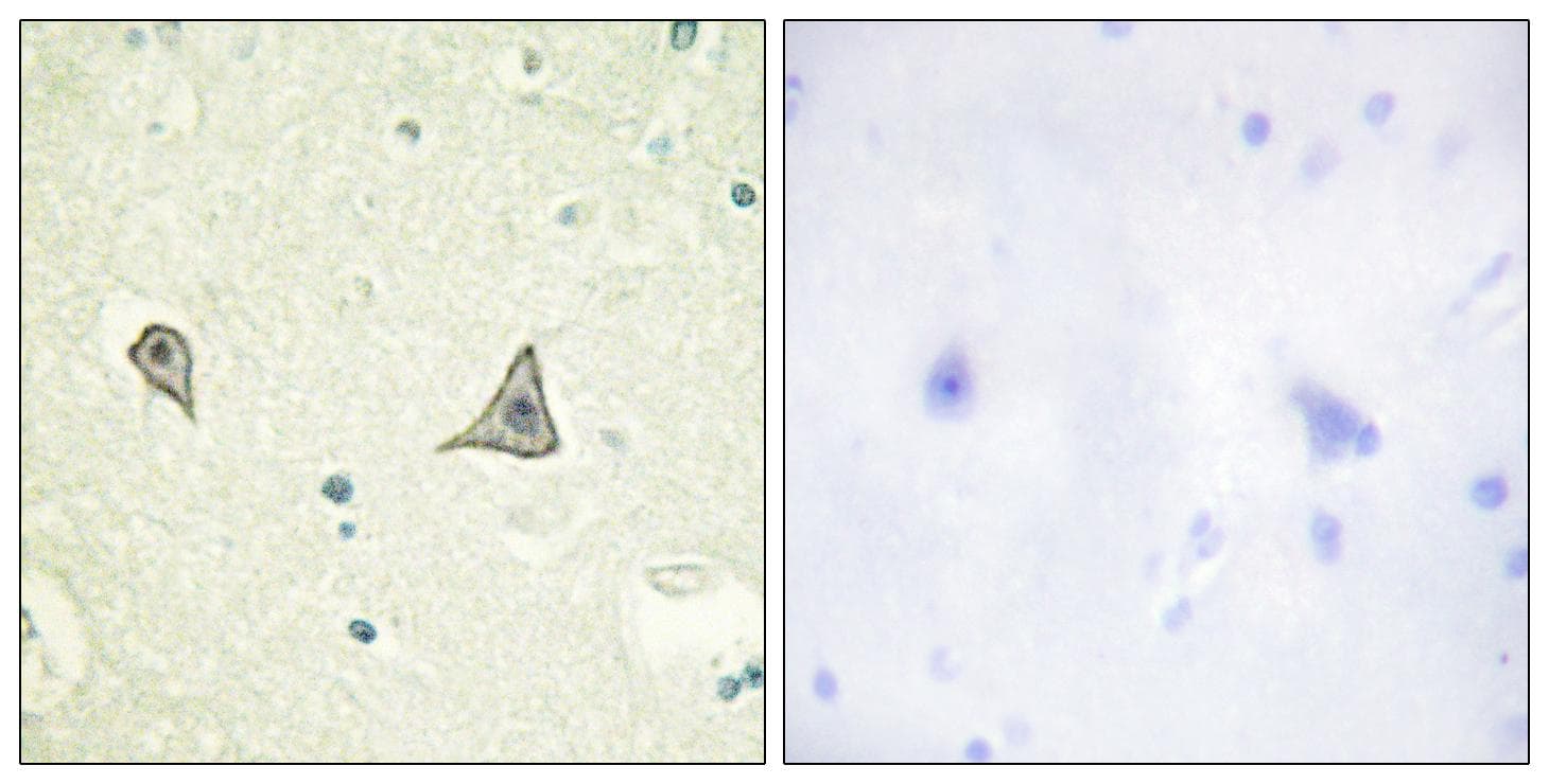 CSF1R / CD115 / FMS Antibody (p723)