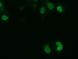 UCK1 Antibody (clone OTI5E9)