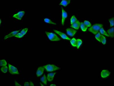 Polyclonal Rabbit anti-Human RPS23 / Ribosomal Protein S23 Antibody (IF)