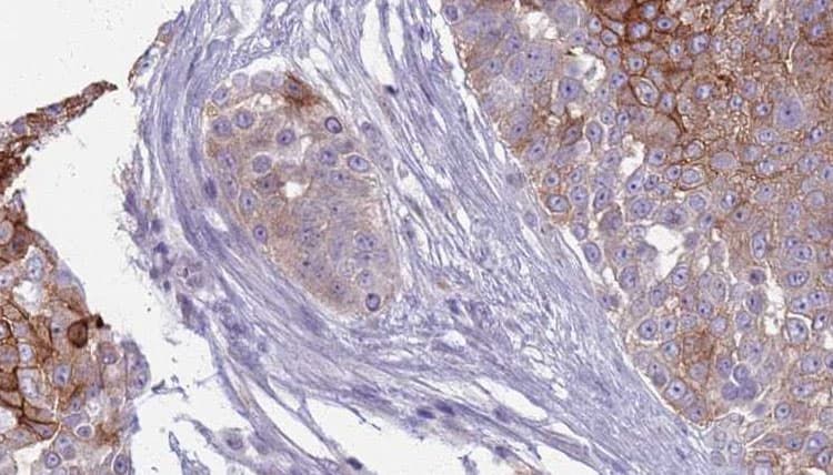 INSRR Antibody