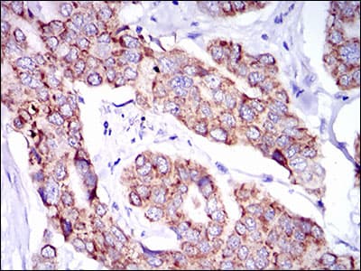 PTPN11 / SHP-2 / NS1 Antibody (clone 6D9)