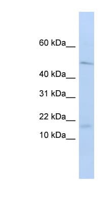 VPREB1 / CD179A Antibody (aa36-85)