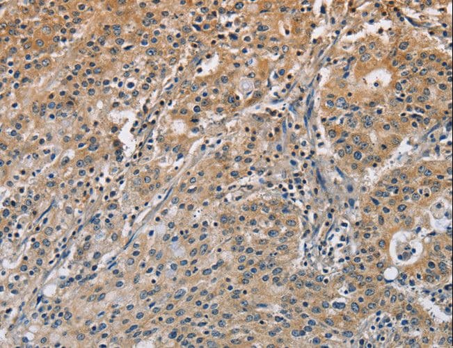 DNMT3A Antibody