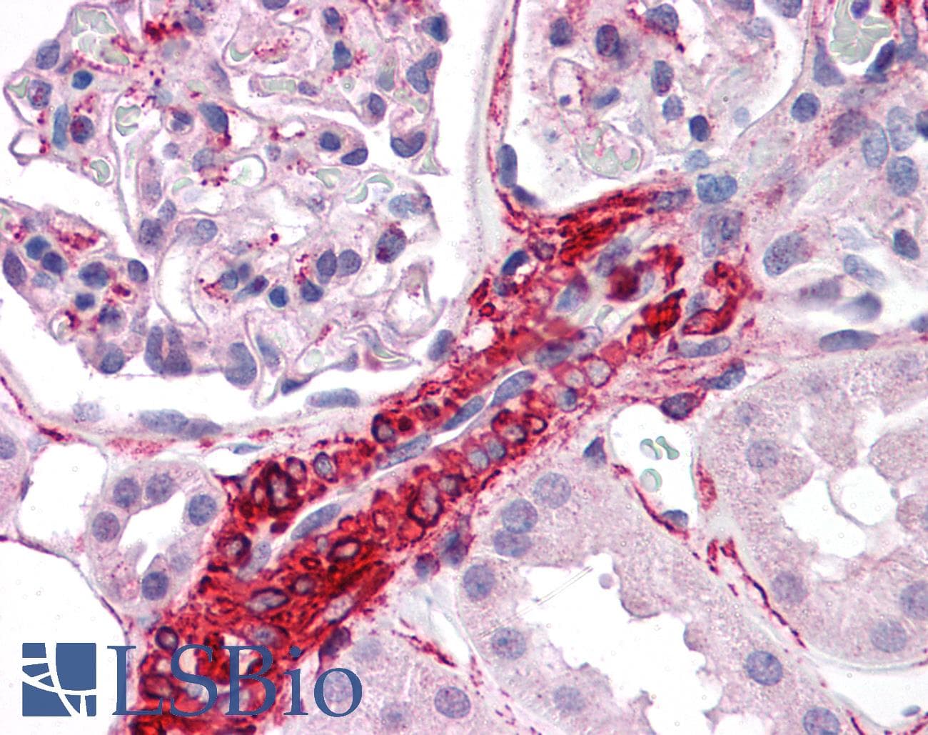 IHC-plus™ Polyclonal Rabbit anti-Human CARD10 / CARMA3 Antibody (IHC)