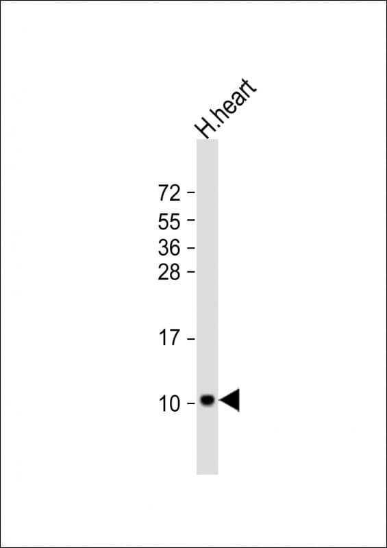 Polyclonal Rabbit anti-Human ATP5E Antibody (aa19-52, WB)