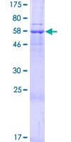 Human SLC25A39 Protein (Recombinant GST)