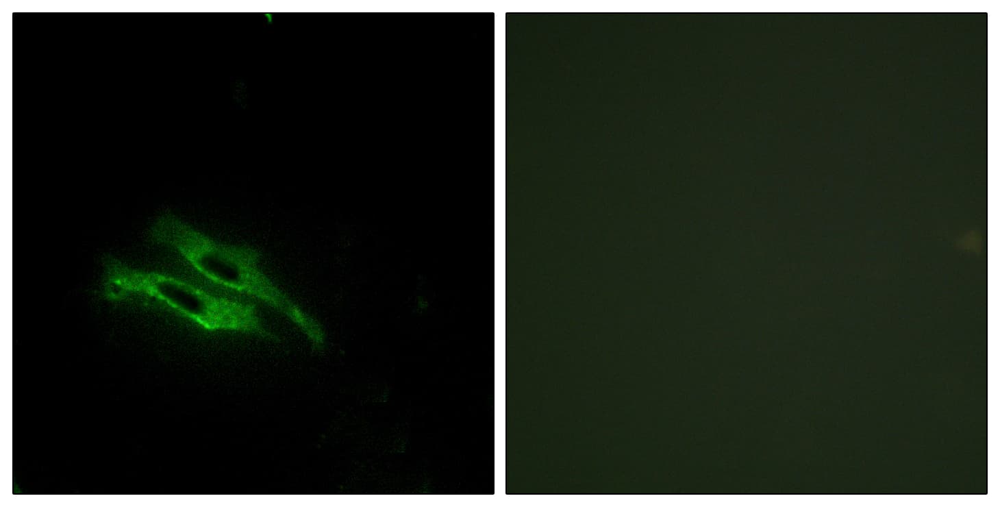 F2 / Prothrombin / Thrombin Antibody (aa391-440)
