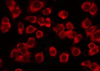 TCP1 Antibody
