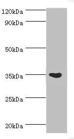 ARG1 / Arginase 1 Antibody (aa1-322)