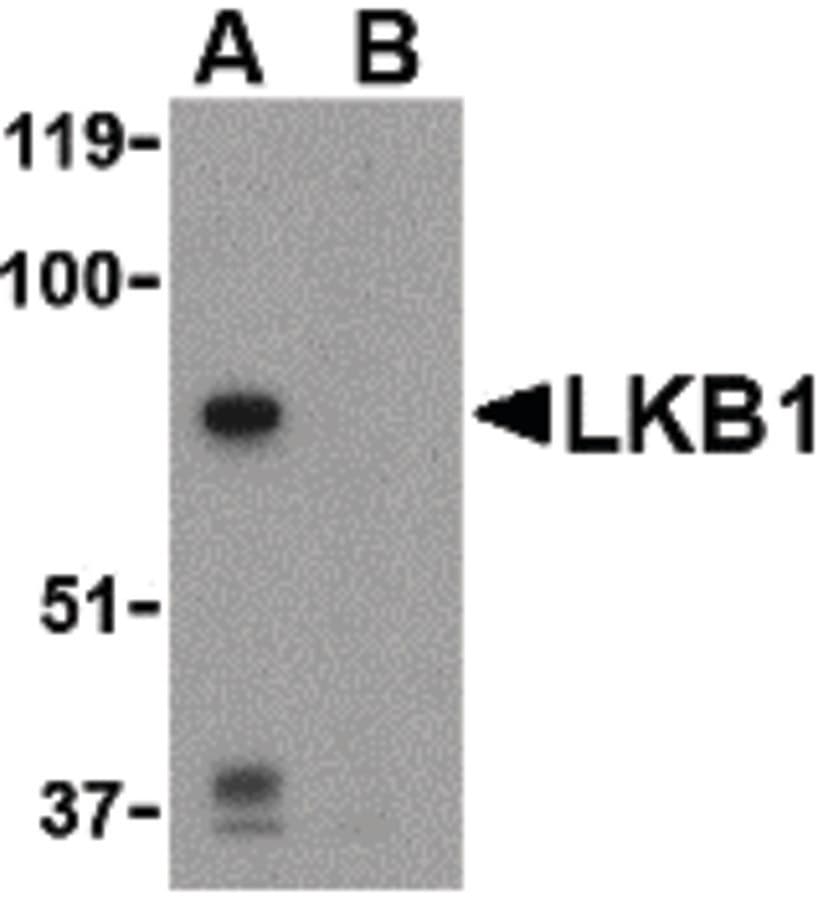 IHC-plus™ Polyclonal Rabbit anti-Human STK11 / LKB1 Antibody (IHC, WB)