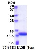 Human CNN2 Protein (Recombinant His)