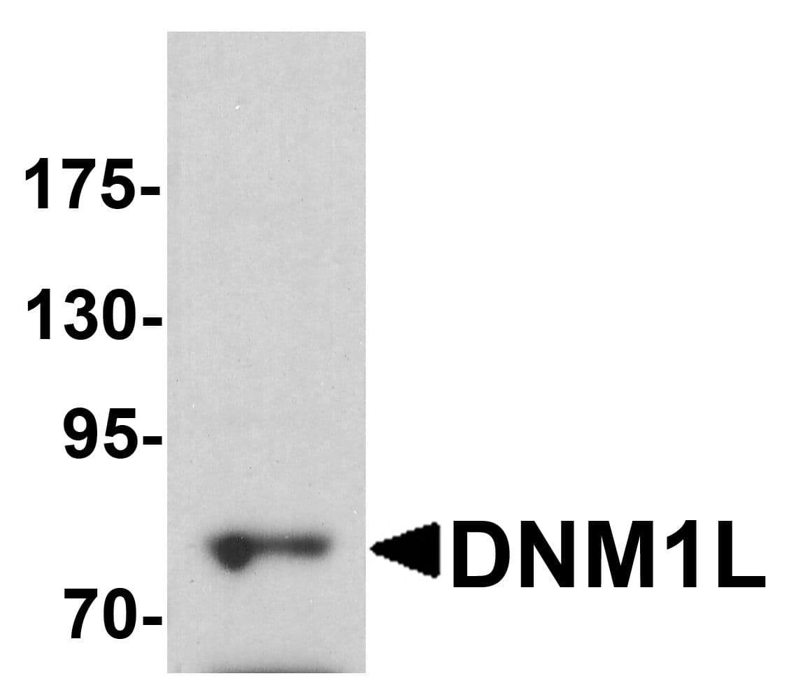 IHC-plus™ Polyclonal Rabbit anti-Human DNM1L / DRP1 Antibody (IHC, IF, WB)