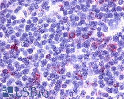 PathPlus™ Polyclonal Rabbit anti-Human CCR7 Antibody (N-Terminus, IHC)