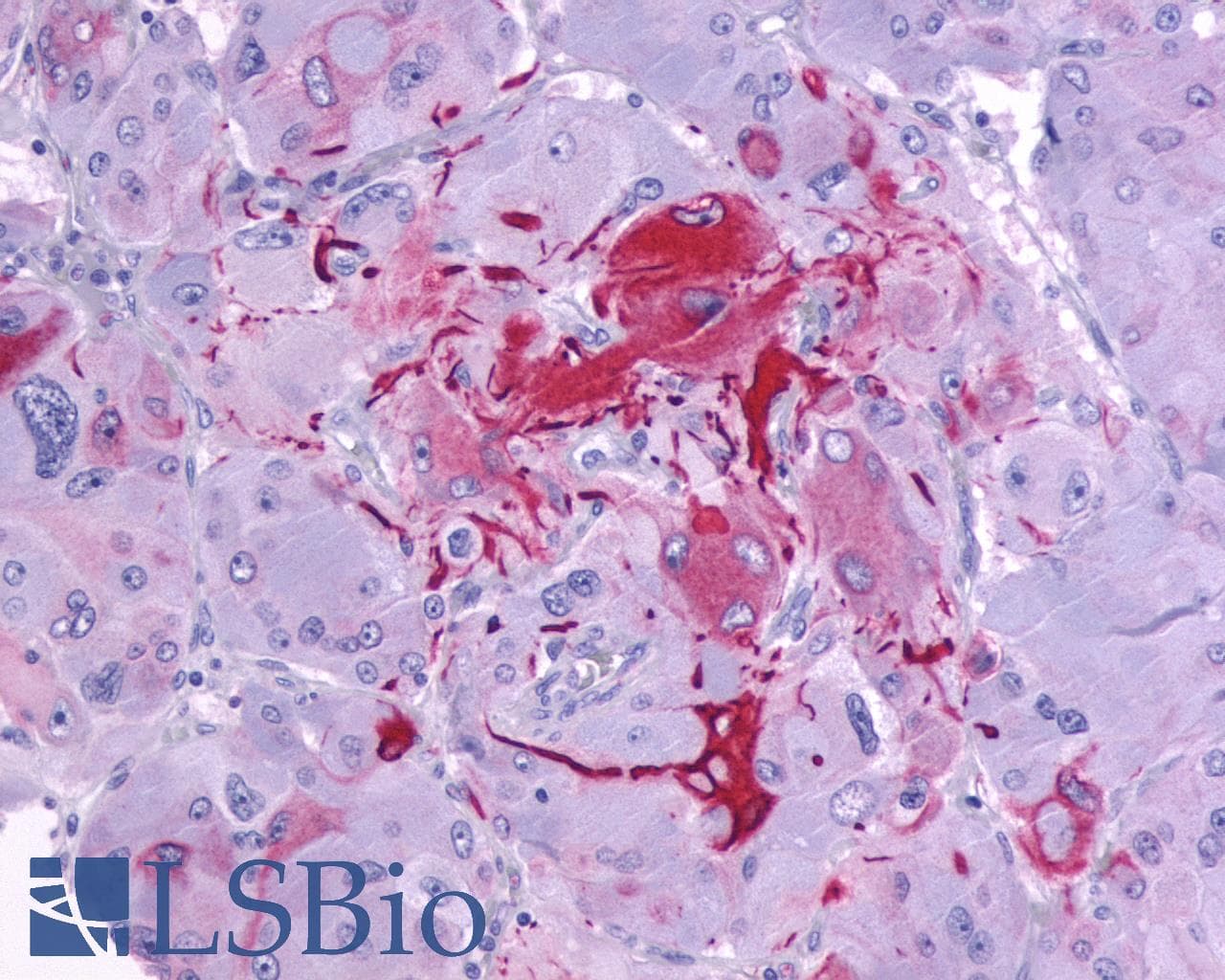 PathPlus™ P2RY14 / GPR105 Antibody (C-Terminus)
