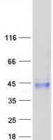 Human SUSD4 Protein (Recombinant Myc-DDK (Flag))