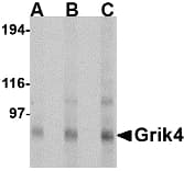 GRIK4 / KA1 Antibody
