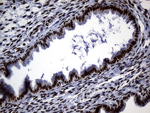 ALOX5 / 5-LOX Antibody (aa18-364, clone OTI1A1)