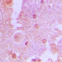 Polyclonal Rabbit anti-Human TBC1D4 / AS160 Antibody (phospho-Thr642, IHC, IF, WB)
