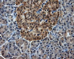 PIM2 / Pim-2 Antibody (clone OTI10A12)