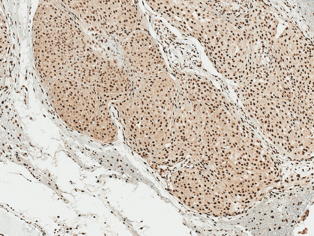 SNCA / Alpha-Synuclein Antibody (phospho-Ser129, APC)