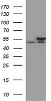 TUBB2B / Tubulin Beta 2B Antibody (clone OTI5H9)