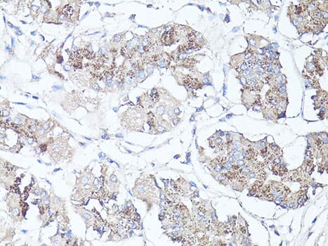 Polyclonal Rabbit anti-Human MAP1LC3B / LC3B Antibody (IHC, IF, WB)