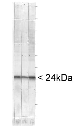 UCHL1 / PGP9.5 Antibody (clone BH7)