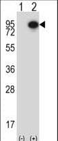 CTTN / Cortactin Antibody (aa273-302)