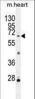 NKPD1 Antibody (aa532-560)
