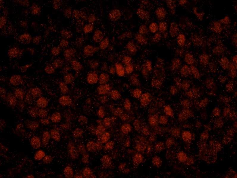 RCOR3 Antibody (aa445-495)
