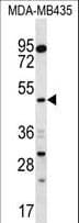 SNX4 Antibody (aa391-420)