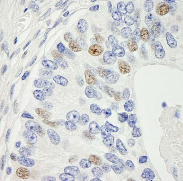 MAD1L1 / MAD1 Antibody (aa1-50)