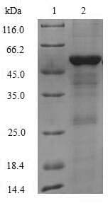 Human IFIH1 / MDA5 Protein (Recombinant 6His-SUMO, N-terminus)