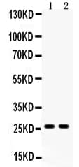 DUT / DUTPase Antibody (aa136-150)