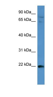 Polyclonal Rabbit anti-Human MAP3K15 / ASK3 Antibody (aa1201-1250, WB)