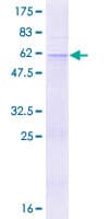 Human ABCA8 Protein (Recombinant GST)