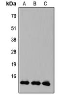 KLF10 + KLF11 Antibody (C-Terminus)