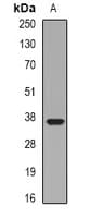LIMS1 / PINCH Antibody