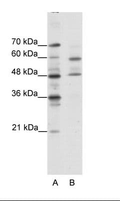 CRTR1 / TFCP2L1 Antibody (aa181-230)