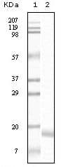 SNCA / Alpha-Synuclein Antibody (clone 2B2D1, 2B2A11)